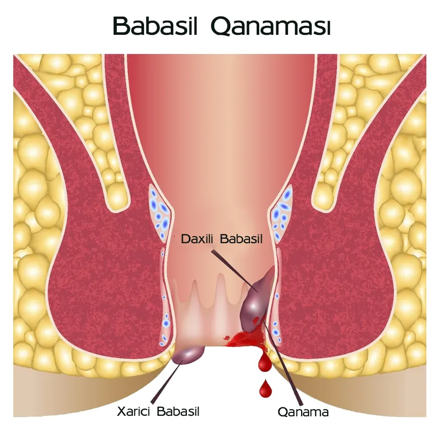 Babasil Qanamasi