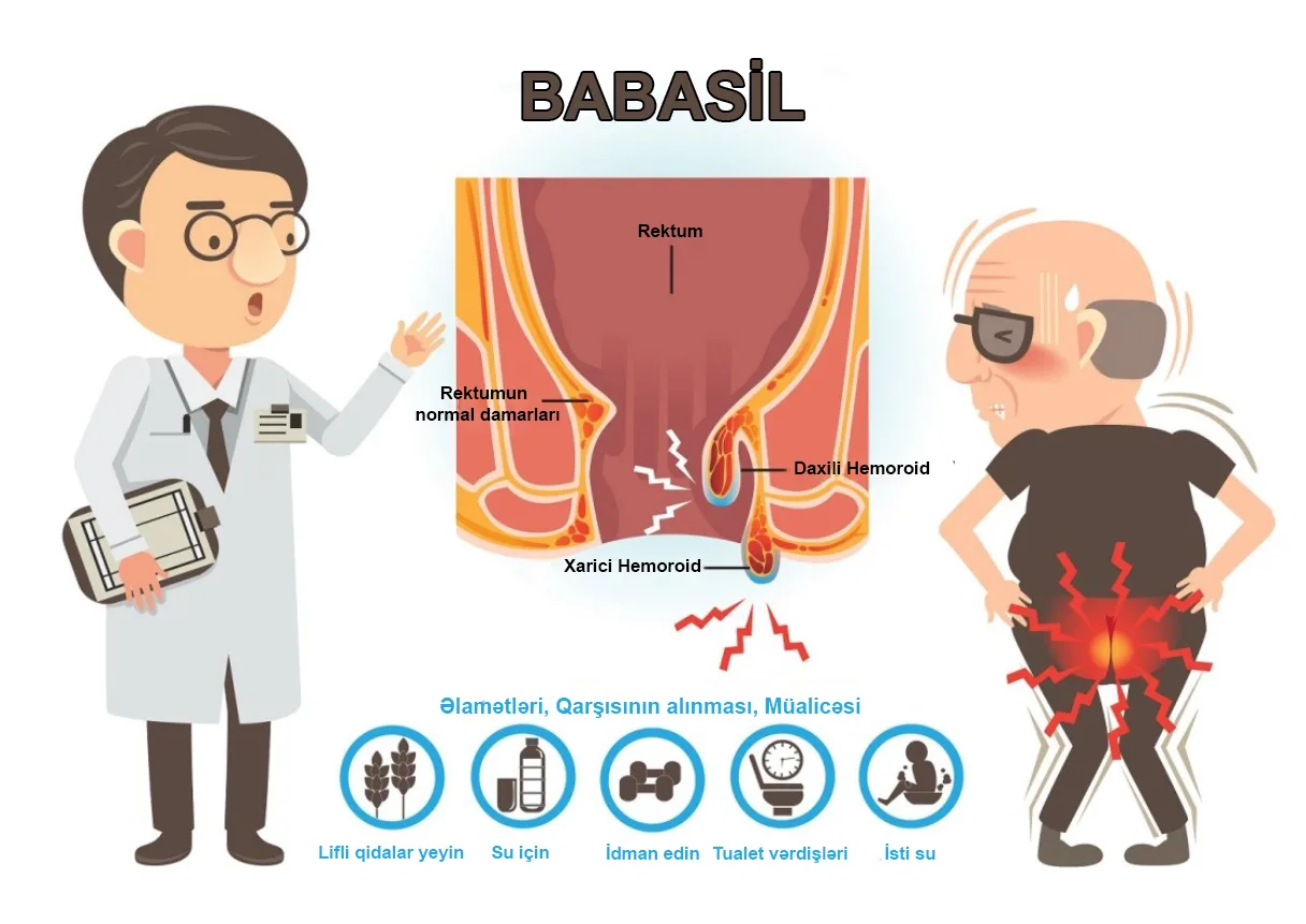Babasilin Evdə Müalicəsi