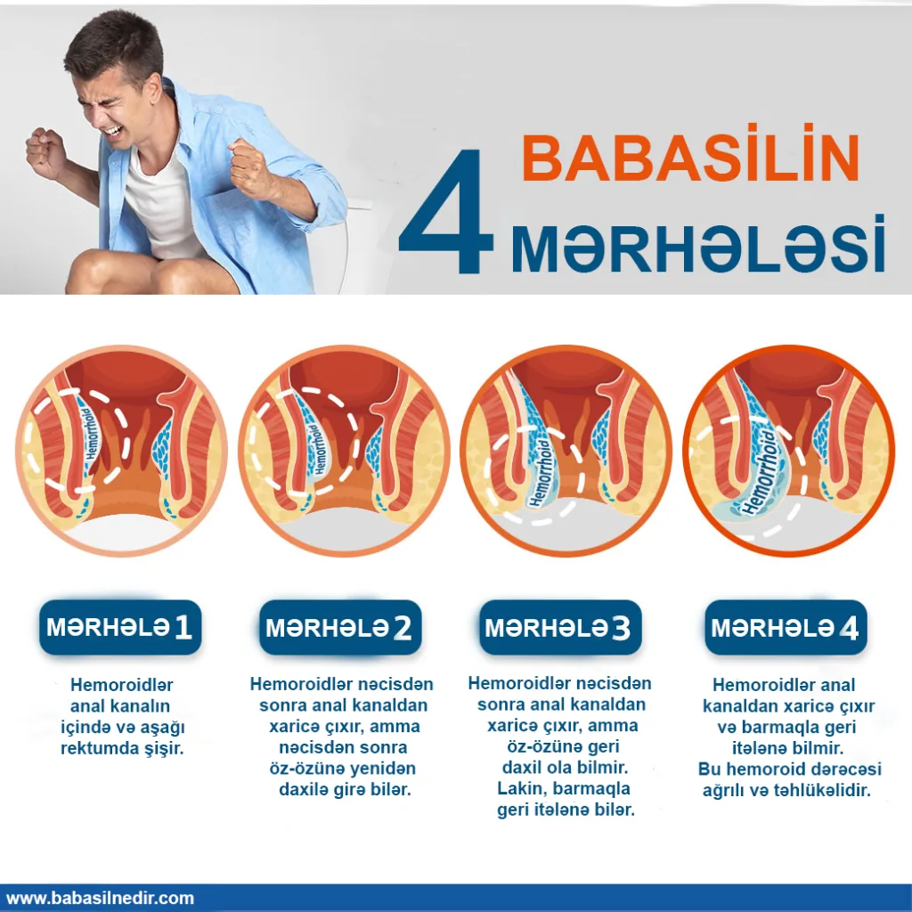 Babasilin Mərhələləri Nələrdir