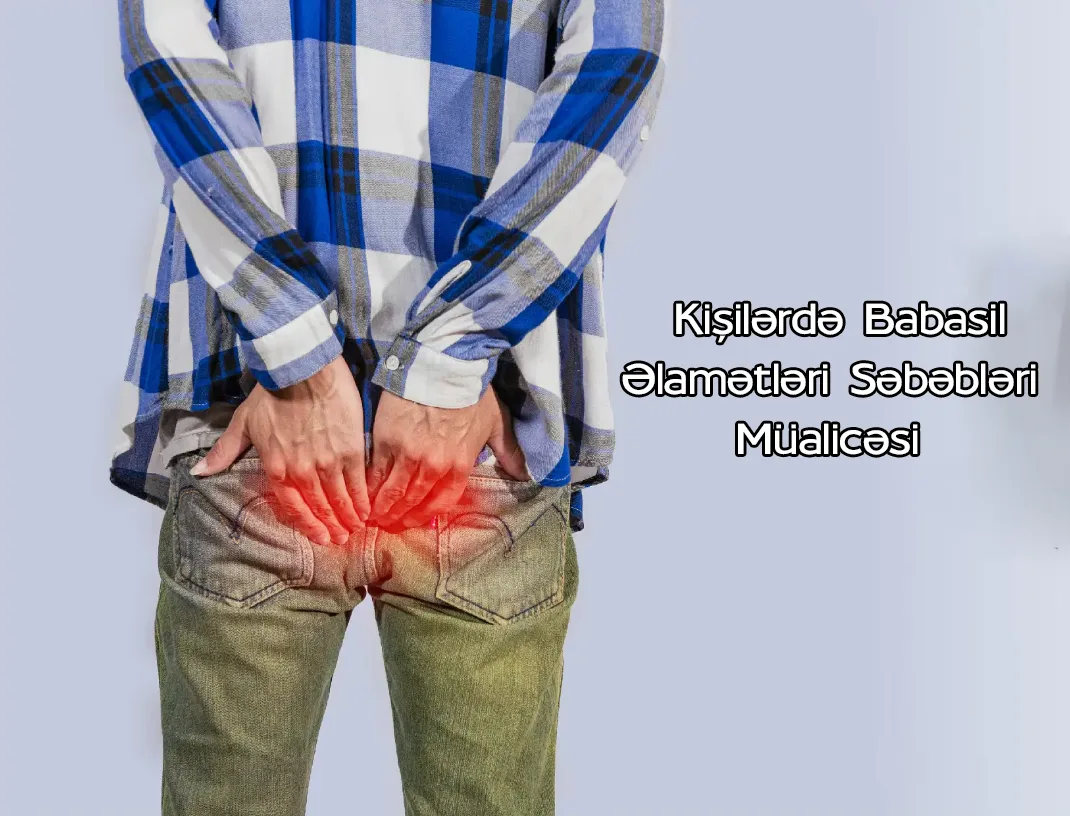 Kişilərdə Babasil – Əlamətləri Səbəbləri və Müalicəsi